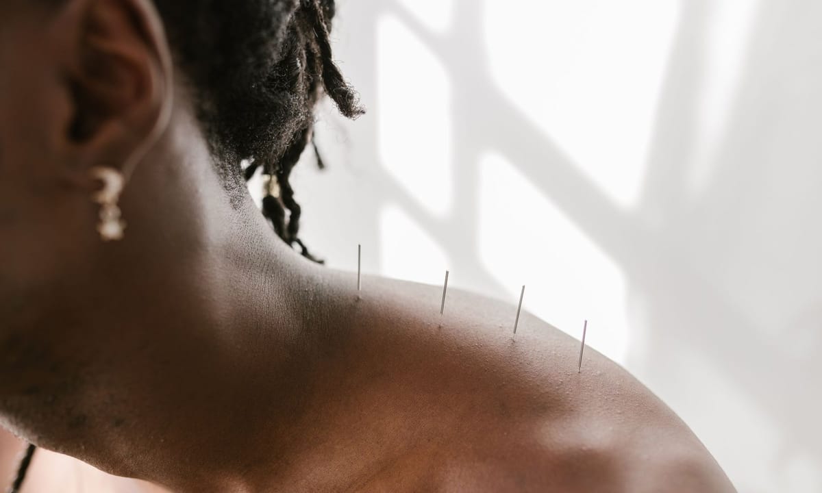 Featured image for Acupuncture in Grande Prairie: What It Treats and What to Expect at Your First Visit