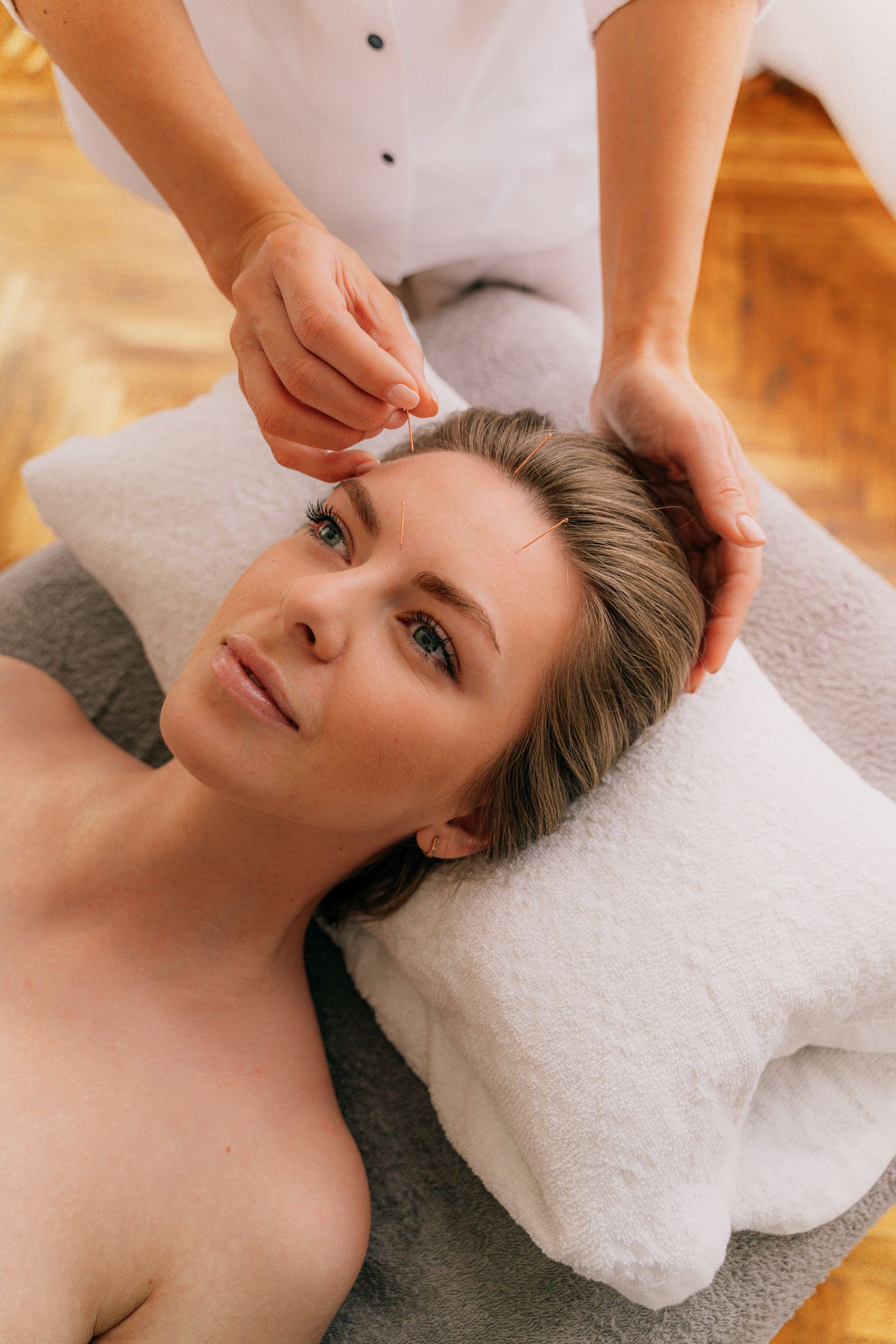 Acupuncturist gently placing fine needles during a cosmetic acupuncture session