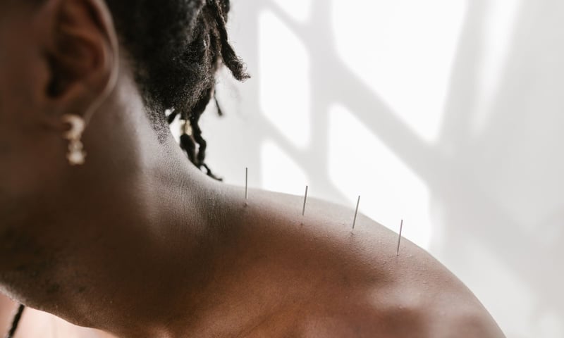 Acupuncture in Grande Prairie: What It Treats and What to Expect at Your First Visit